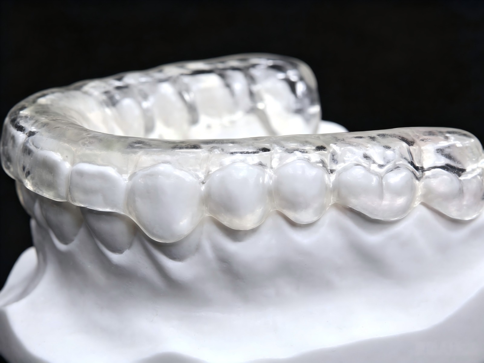 Clear Essix retainer on a dental model