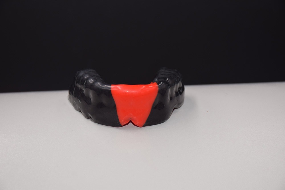 Diagnostic wax bite rim on a working model